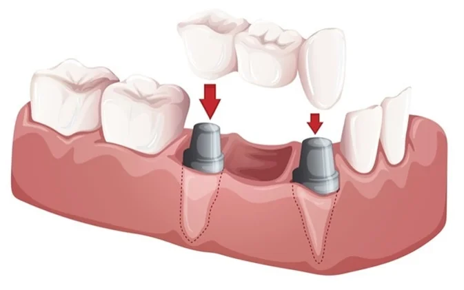 omdentalclinic